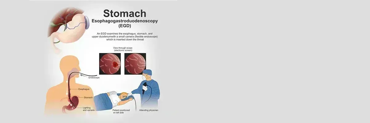 ESOPHAGO GASTRO DUODENOSCOPY